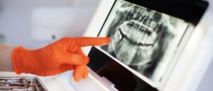 dental x-ray imaging to prevent oral health issues